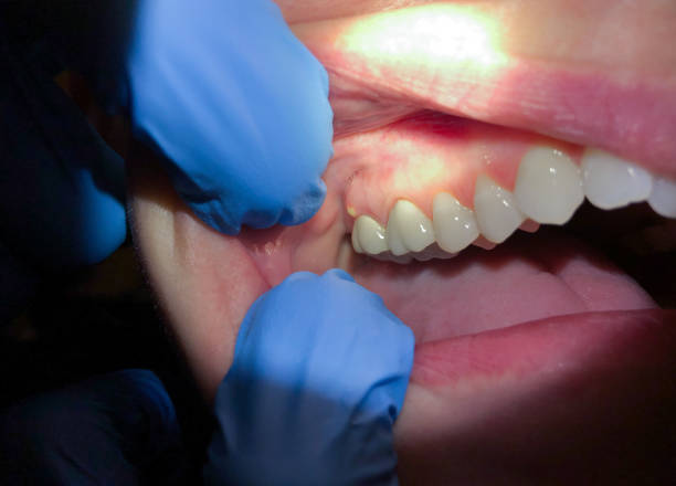 Best Same-Day Emergency Dentist in Contra Costa Centre, CA